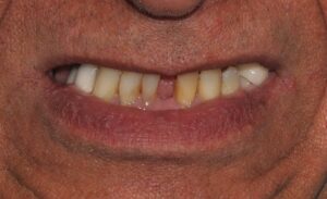 Elim Dental dentist in Mount Kisco, NY DR. JIN SUB OH, DMD, MS Schema yoast